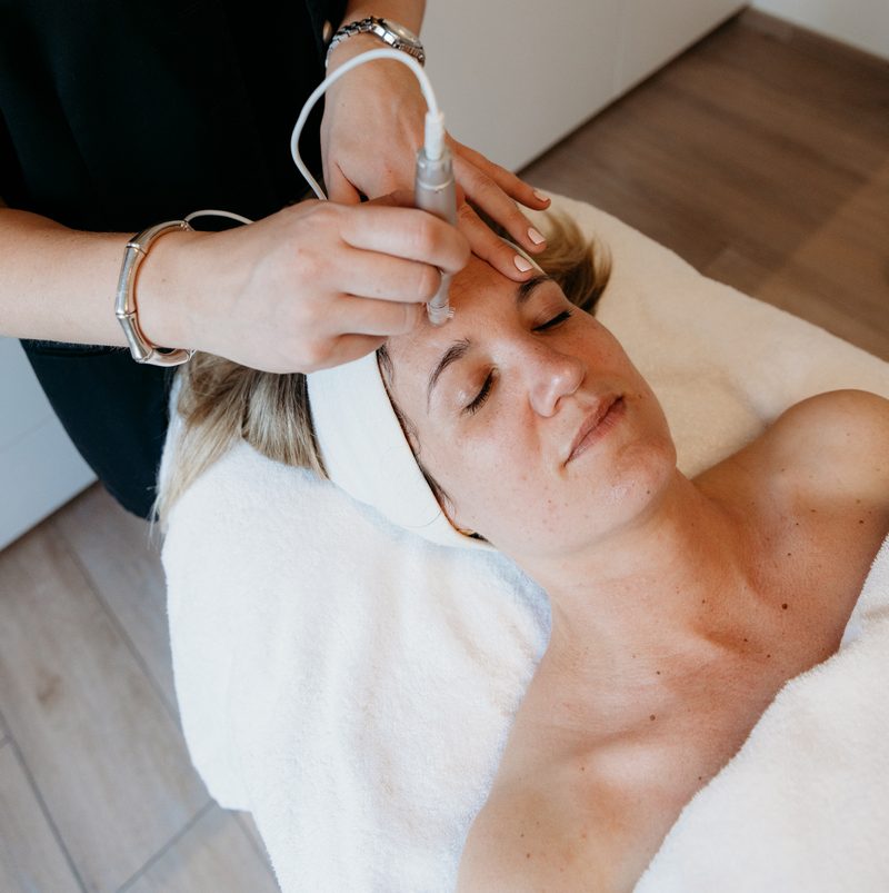 Microneedling behandeling voor acnelittekens bij CELINIQ