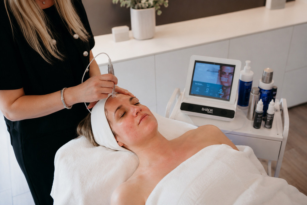 Microneedling behandeling bij CELINIQ Huidinstituut Melle